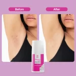 Touch Bright Roll On for Ingrown Hair - Image 3